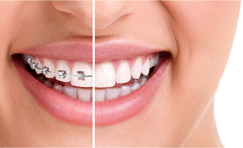 ortho